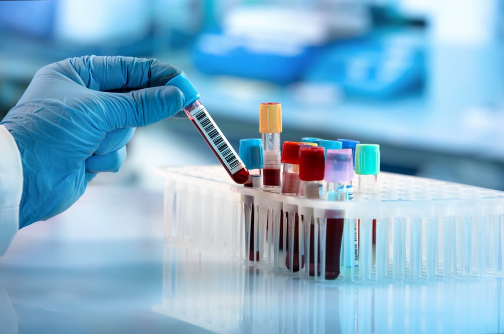 Profissional de Biomedicina com amostras de sangue